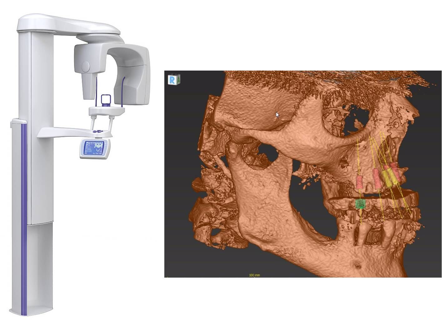 CT Scans North Houston, TX Periodontics Digital Dentistry